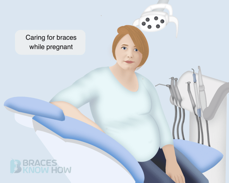 Braces and Pregnancy: All You Need to Know
