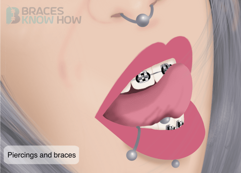 Lip Piercings and Braces: Is It Safe to Have Both?