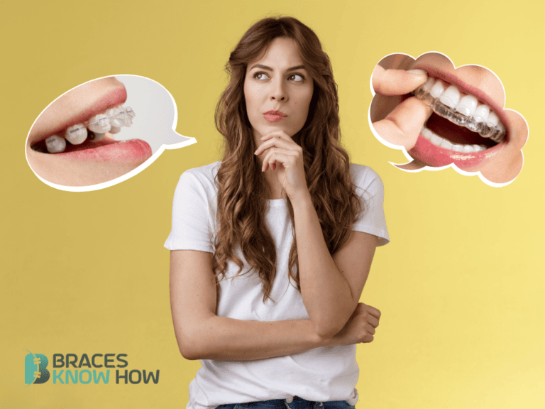 The Braces Decision: How to Know What Type You Need