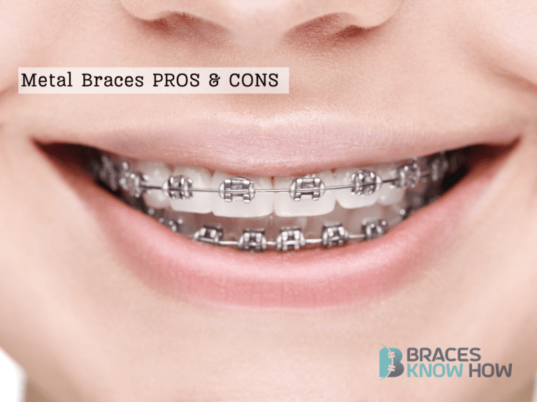 Metal Braces: Weighing the Pros and Cons