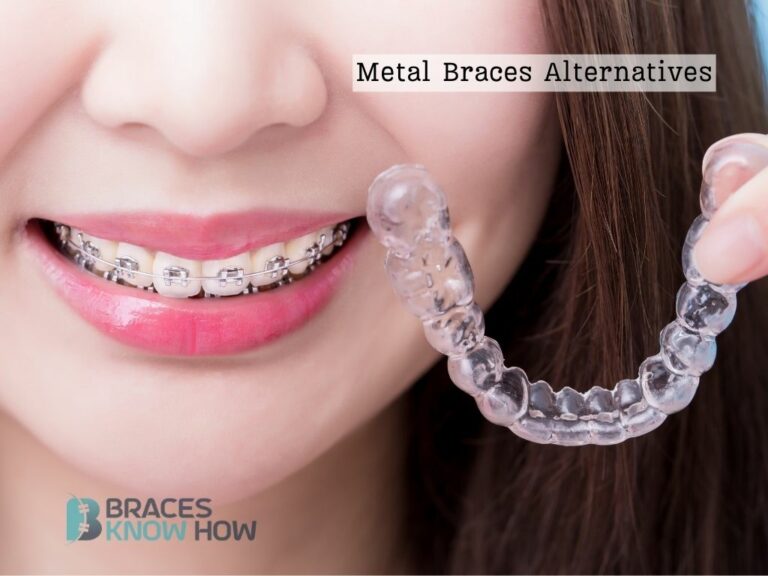 8 Metal Braces Alternatives to Upgrade Your Smile