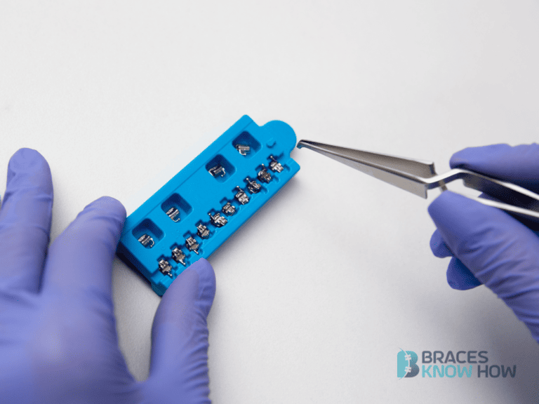 What Are Metal Braces Made Of? Answering Common Questions