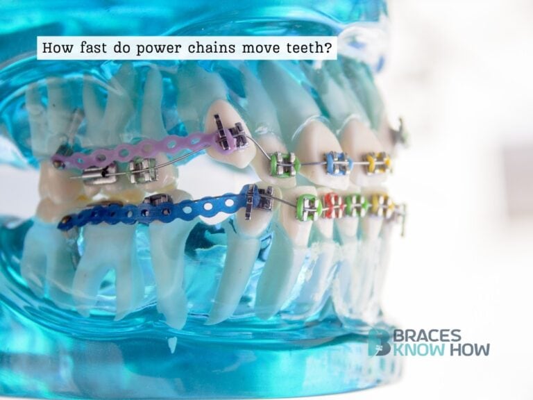 How Fast Do Power Chains Move Teeth? Exact Numbers