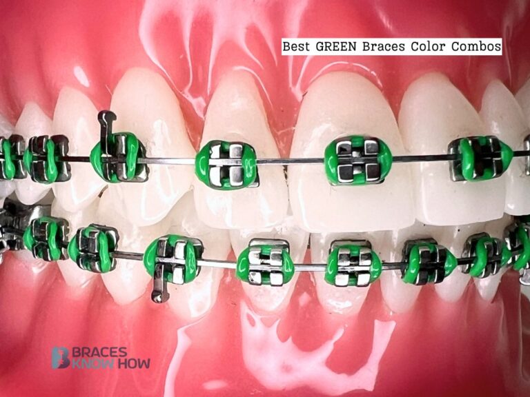 Green Braces: 7 Inspiring Combinations to Try at Least Once!