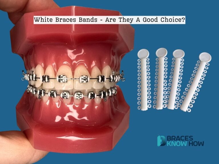 White Braces Bands: Care Tips and 5 Fun Combinations
